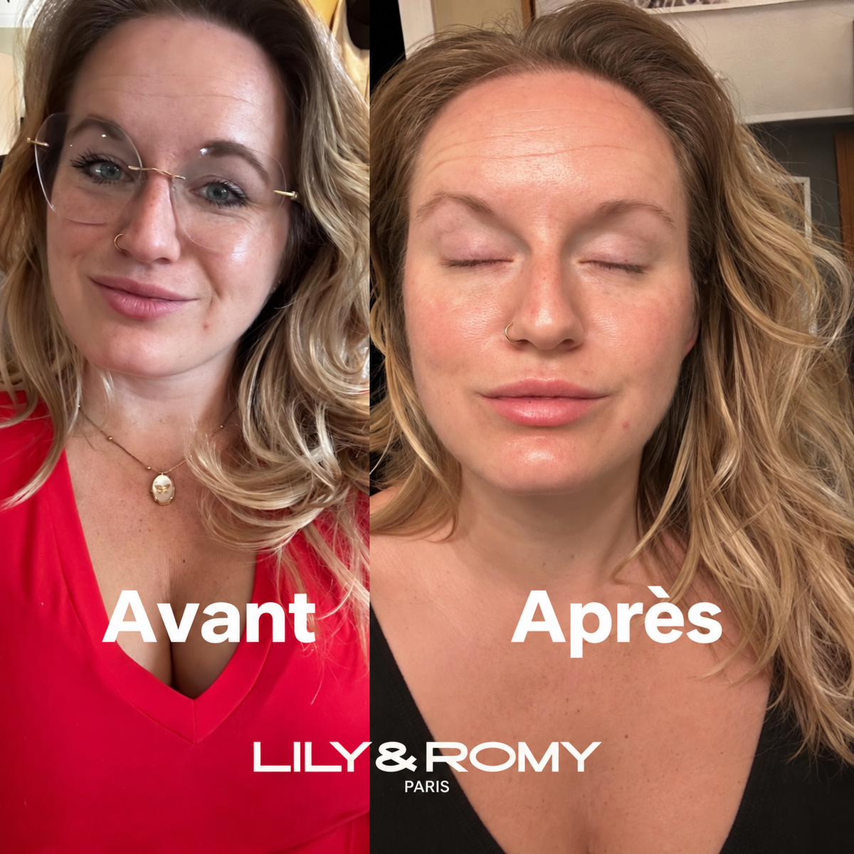 Après utilisation du Masque de Lily